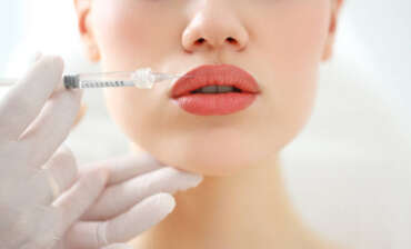 Lip Lift Ameliyatı Olanlar