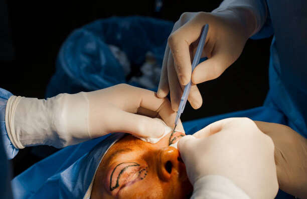 Upper Eyelid Aesthetics