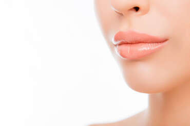 Lip Lift Ameliyatı Sonrası