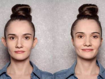 كيف يتم إجراء تجميل الأذن البارزة؟