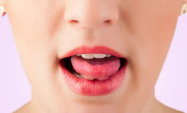 What is Salivary Gland Surgery?